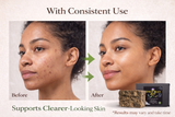 100% Natural African Black Soap – Deep Cleansing Bar Made in Ghana